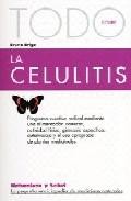 Todo sobre la celulitis