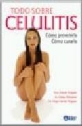 Todo sobre la celulitis: como prevenirla, como curarla